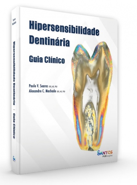 Hipersensibilidade Dentinária Guia Clínico