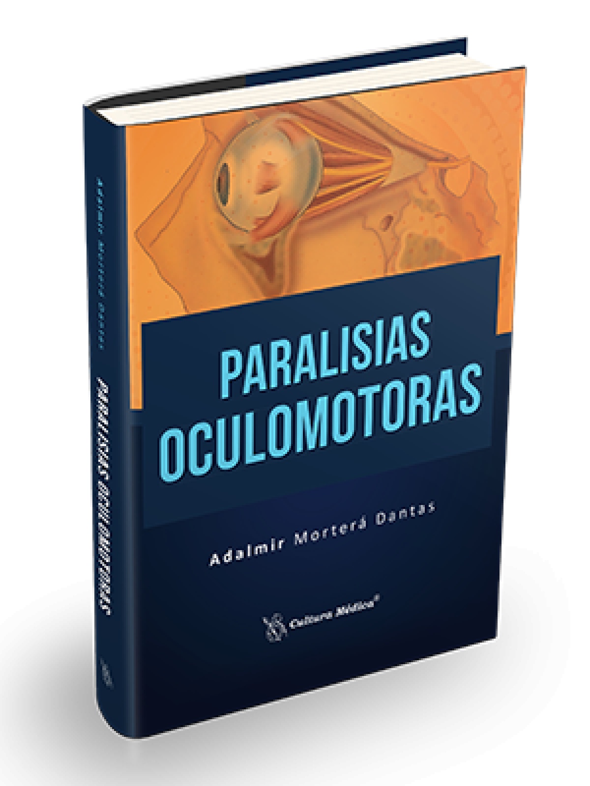 Paralisias Oculomotoras