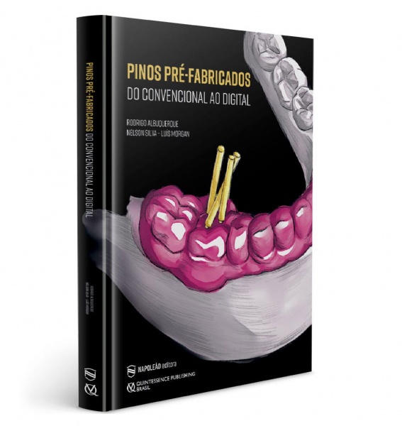 Pinos Pré-Fabricados Do Convencional Ao Digital