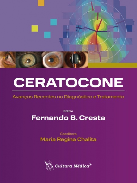 Ceratocone – Avanços Recentes No Diagnóstico E Tratamento