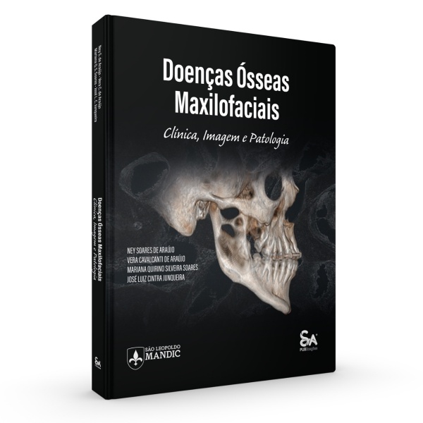 Doenças Ósseas Maxilofaciais Clínica Imagem E Patologia