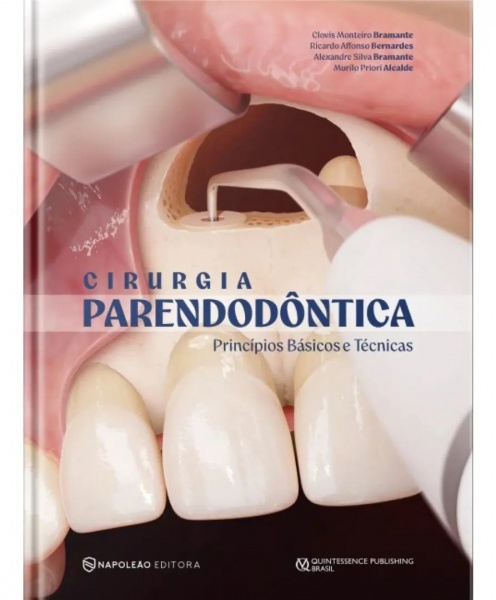 Cirurgia Parendodôntica - Princípios Básicos E Técnicas