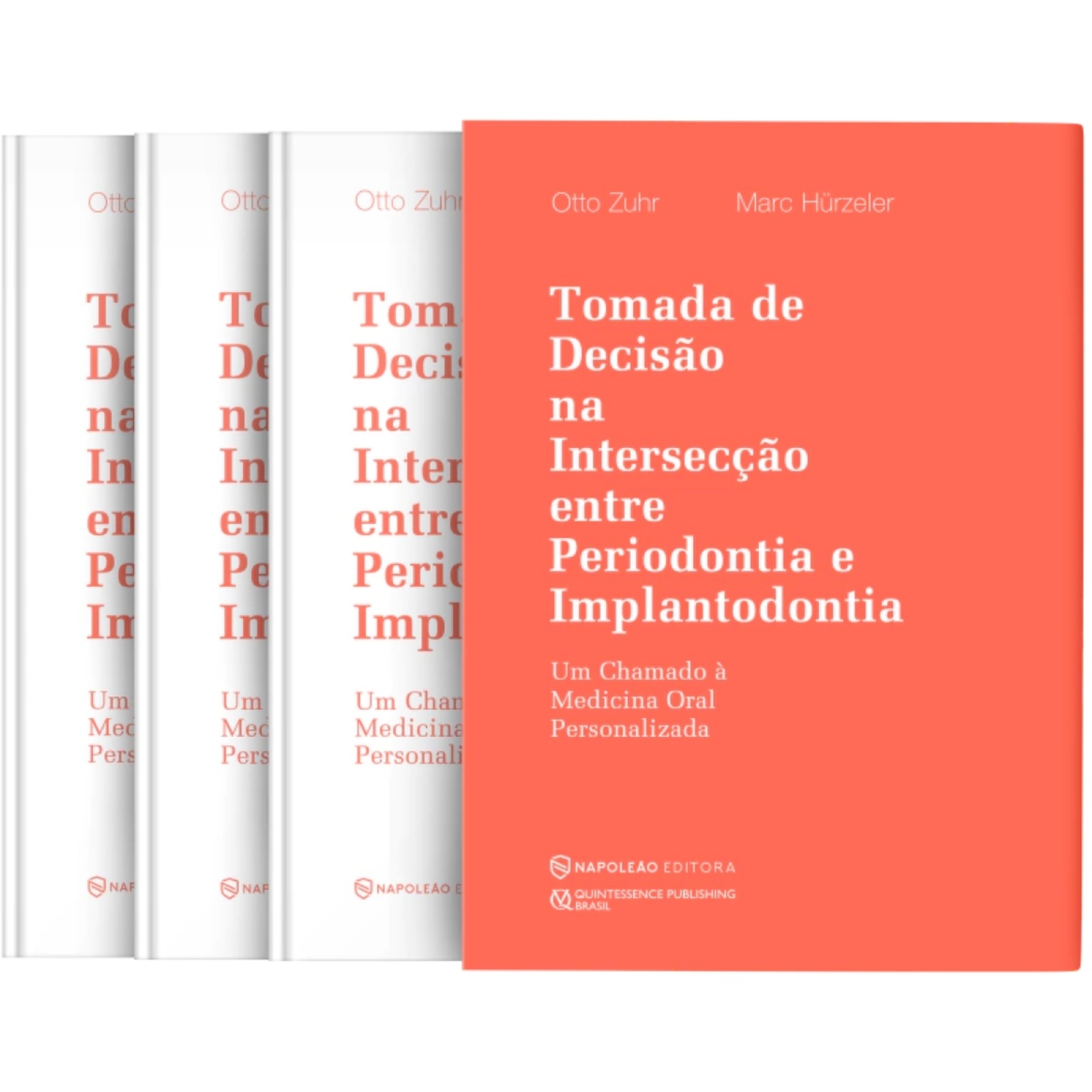 Tomada De Decisão Na Intersecção Entre Periodontia E Implantodontia - Um Chamado À Medicina Oral Personalizada