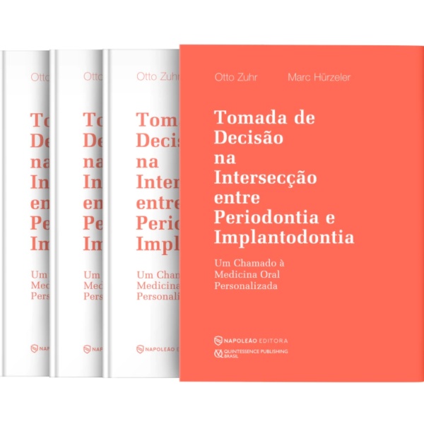 Tomada De Decisão Na Intersecção Entre Periodontia E Implantodontia - Um Chamado À Medicina Oral Personalizada