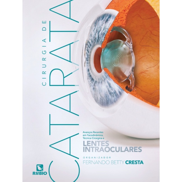 Cirurgia De Catarata Avanços Recentes Em Facodinâmica, Técnica Cirúrgica E Lentes Intraoculares