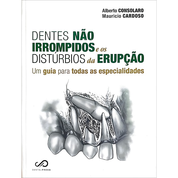 Dentes Não Irrompidos E Os Distúrbios Da Erupção - Um Guia Para Todas As Especialidades