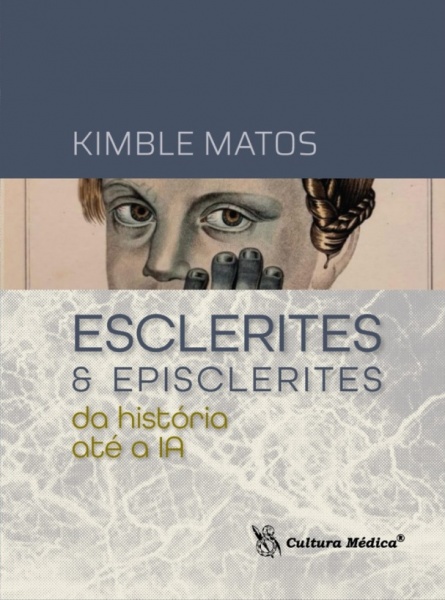 Esclerites & Episclerites – Da História Até A Ia